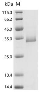 Recombinant Human Protein-glutamine gamma-glutamyltransferase K (TGM1), partial