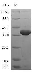 Recombinant Human TGFB1-induced anti-apoptotic factor 1 (TIAF1)