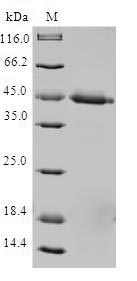 Recombinant Human Mitochondrial import inner membrane translocase subunit Tim17-A (TIMM17A)