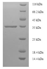 Recombinant Human Tumor protein D52 (TPD52)