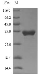 Recombinant Human Transient receptor potential cation channel subfamily A member 1 (TRPA1), partial