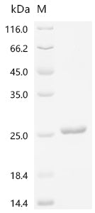 Recombinant Mouse Thyrotropin subunit beta（Tshb), partial