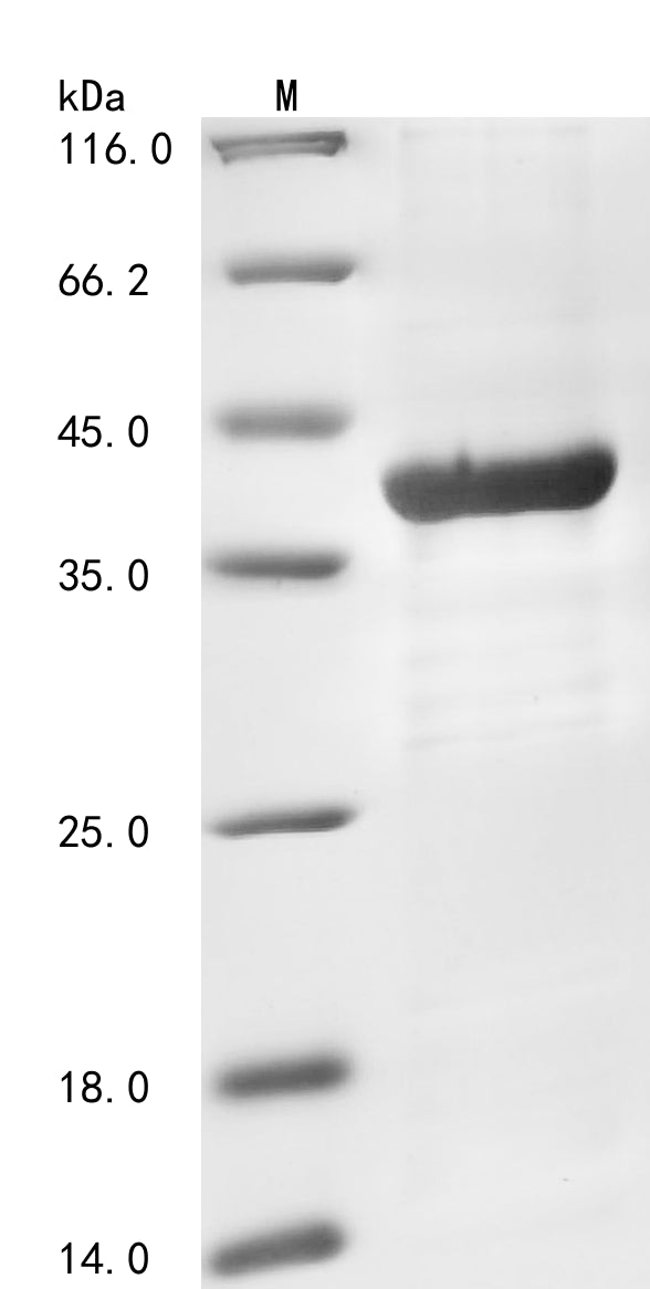 Recombinant Human Non-receptor tyrosine-protein kinase TYK2 (TYK2), partial