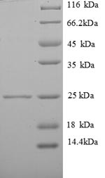 Recombinant Human Vesicle-associated membrane protein 7 (VAMP7), partial