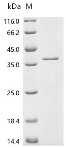 Recombinant Human CCN family member 5 (CCN5)