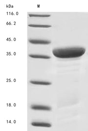 Recombinant Human 14-3-3 protein zeta/delta (YWHAZ), partial