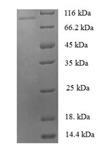 Recombinant Human Zinc finger protein 175 (ZNF175)