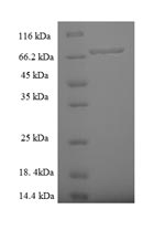 Recombinant Human Zinc finger protein 212 (ZNF212)