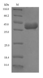 Recombinant Triticum aestivum Omega-5 gliadin, partial