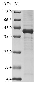 Recombinant Human MIG7 (MIG7)