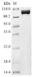 Recombinant Middle East respiratory syndrome-related coronavirus Orf1ab, partial