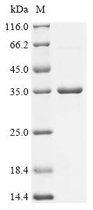 Recombinant Escherichia coli Intermembrane phospholipid transport system lipoprotein MlaA (mlaA)