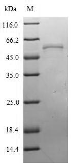 Recombinant Influenza A virus Nucleoprotein (NP)