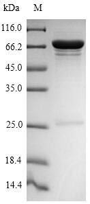 Recombinant Influenza A virus Nucleoprotein (NP)