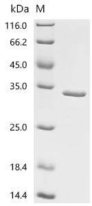 Recombinant Francisella tularensis subsp. holarctica Chaperonin GroEL (groEL), partial