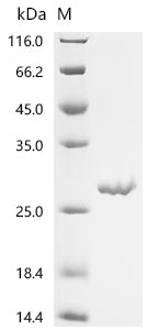 Recombinant Abrus precatorius Abrin-d, partial