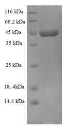 Recombinant Zaire ebolavirus Super small secreted glycoprotein (GP)