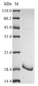 Recombinant Human immunodeficiency virus type 1 group M subtype K Protein Vpr (vpr)