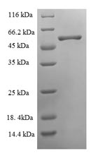 Recombinant Chicken Ovoinhibitor (OIH), partial