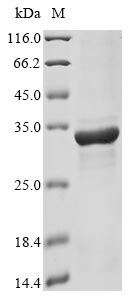 Recombinant Toxoplasma gondii Dense granule protein 2 (GRA2)