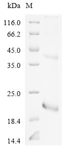 Recombinant Rat Phospholipase A2, membrane associated (Pla2g2a)