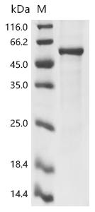 Recombinant Gibbon ape leukemia virus Envelope glycoprotein (env), partial