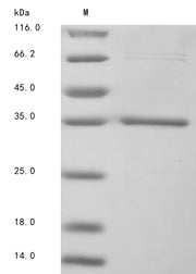 Recombinant Moraxella bovis Fimbrial protein 1