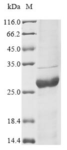 Recombinant Human Trifunctional purine biosynthetic protein adenosine-3 (GART), partial