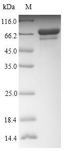 Recombinant Influenza A virus Nucleoprotein (NP)