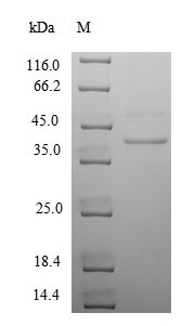 Recombinant Human cytomegalovirus Uncharacterized protein UL130 (UL130), partial