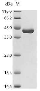 Recombinant Listeria monocytogenes serovar 1/2a Internalin B (inlB), partial