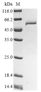 Recombinant Citrobacter freundii Tyrosine phenol-lyase (tpl)