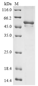 Recombinant Venezuelan equine encephalitis virus Polyprotein P1234, partial