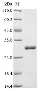 Recombinant Lake Victoria marburgvirus RNA-directed RNA polymerase L (L), partial
