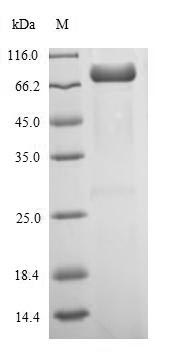 Recombinant Influenza A virus Nucleoprotein (NP)