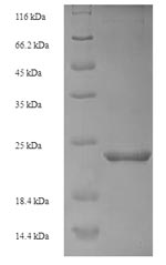 Recombinant Danio rerio Metallothionein-1 (mt)