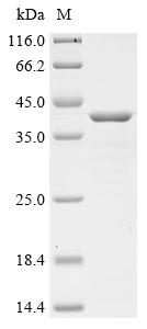 Recombinant Porcine parvovirus Capsid protein VP2, partial
