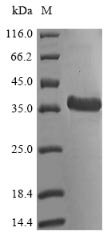 Recombinant Mycobacterium tuberculosis Probable cutinase Rv1984c (Rv1984c)