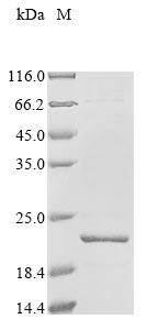 Recombinant Streptococcus agalactiae serotype III Holo-[acyl-carrier-protein] synthase (acpS)