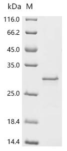 Recombinant Escherichia coli O157:H7 Uncharacterized protein yqgB (yqgB)
