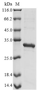 Recombinant Epstein-Barr virus Secreted protein BARF1 (BARF1)
