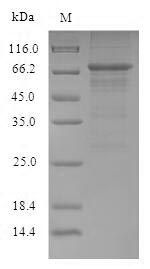 Recombinant Influenza A virus Nucleoprotein (NP)