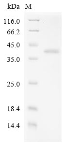 Recombinant Human adenovirus C serotype 5 Hexon protein (L3) (T273A), partial