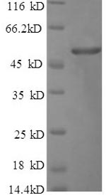 Recombinant Bacillus thuringiensis subsp. Pesticidal crystal protein cry1Ac (cry1Ac), partial