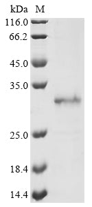 Recombinant Aequorea victoria Aequorin-1
