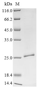 Recombinant Aequorea victoria Aequorin-1