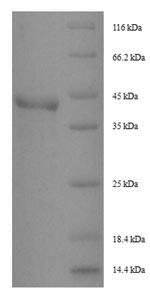 Recombinant Dermatophagoides pteronyssinus Peptidase 1 (DERP1)