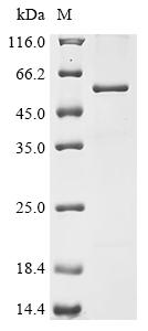 Recombinant Measles virus Hemagglutinin glycoprotein (H), partial, Biotinylated