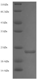Recombinant Enterobacteria phage 933W Shiga-like toxin 2 subunit B (stxB2)