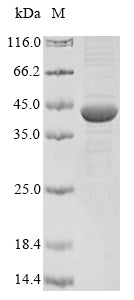 Recombinant Pseudomonas aeruginosa Exotoxin A regulatory protein (toxR)